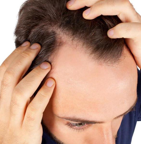 Ozontherapie für das Haar: eine Beschreibung des Verfahrens, Hinweise, Bewertungen