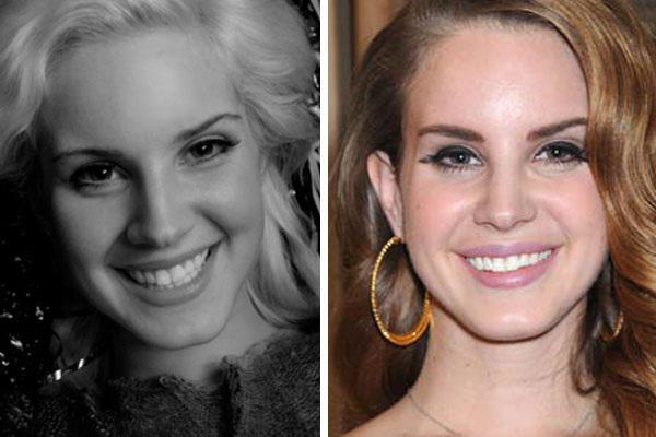 Lana Del Rey zu Kunststoffen. Wie hat sich das Gesicht verändert?