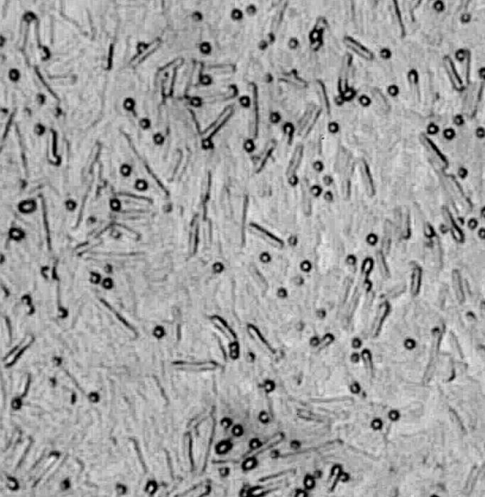 Welche Rolle spielen Sporen im Leben von Bakterien? Selbsterhaltungsmechanismus