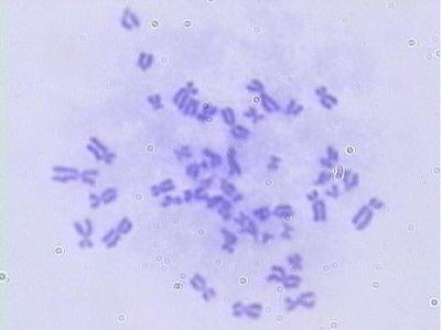 Chromosomenreplikation