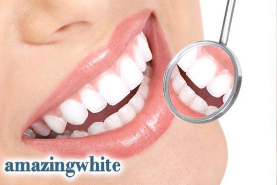 Whitening System Amazing White beim Zahnarzt Bewertungen