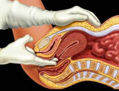 was ist Gebärmutterhals-Erosion