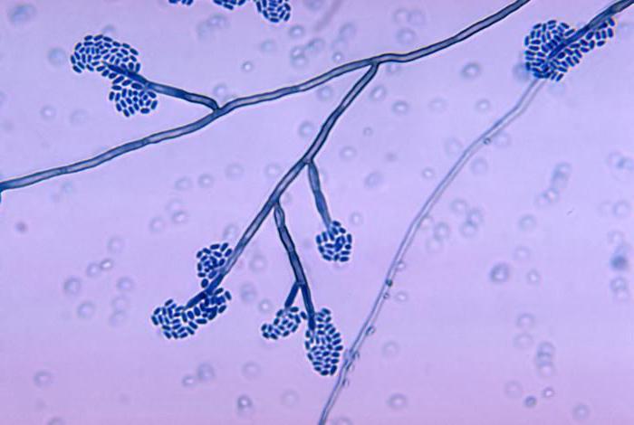 pathogene Pilze auf der Haut