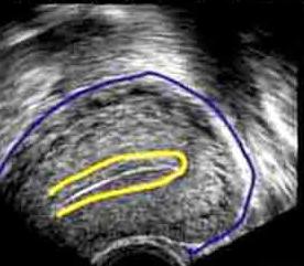 Uterusgröße des Uterus