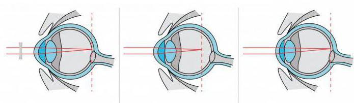 Augen-Relax-Programm