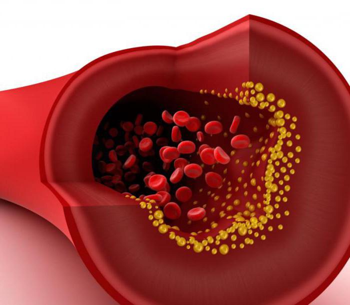 Arterienwandschichten